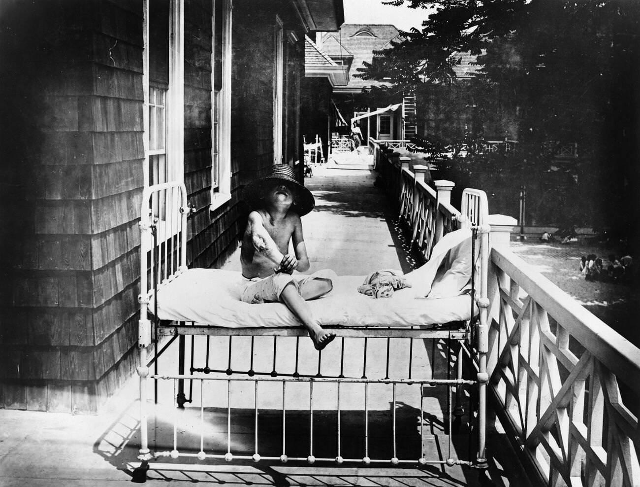 Tubercular Child At Sea Breeze Hospital, 1900-1920