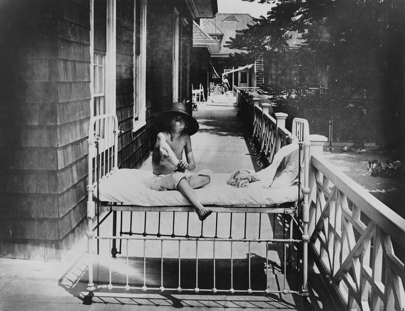Child With Tuberculosis Seated Outdoors At Sea Breeze Hospital, Early 1900S