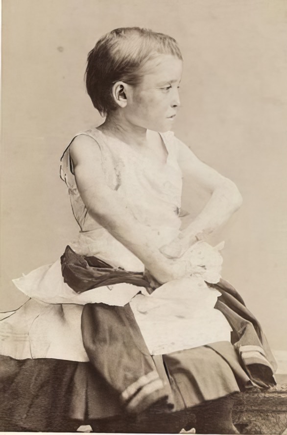 Case No. 25,745: Annie Wolff, circa 1900.