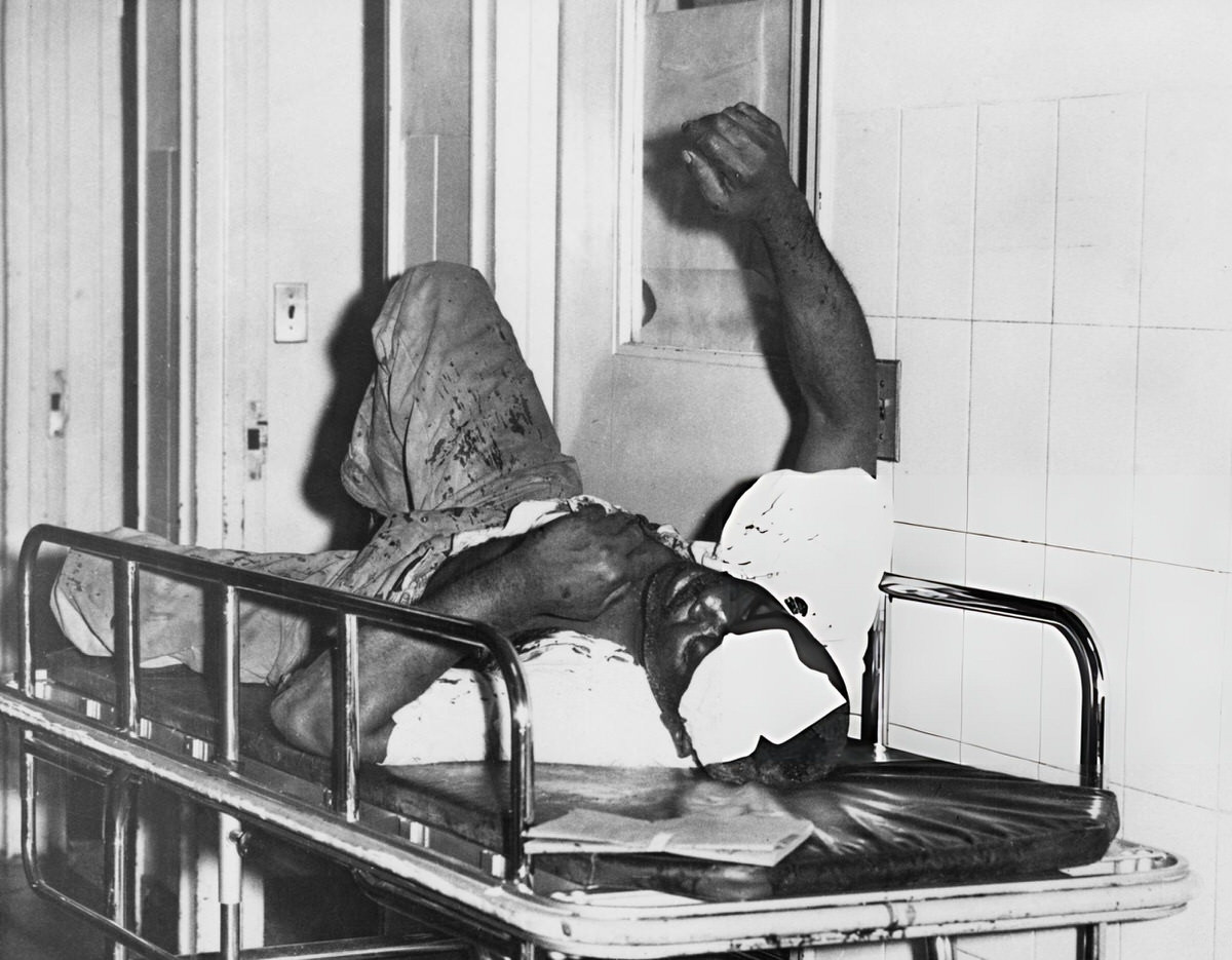 Man Awaiting Hospital Treatment After Being Hit By A Bottle During The Harlem Riots, 1964.